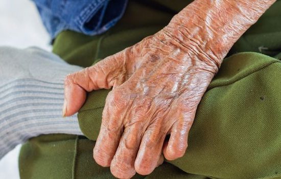 Kasus Kusta di Karawang Meningkat pada 2025, Dinkes Tekankan Gejala Awal dan Layanan Pengobatan Gratis