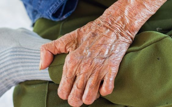 Kasus Kusta di Karawang Meningkat pada 2025, Dinkes Tekankan Gejala Awal dan Layanan Pengobatan Gratis